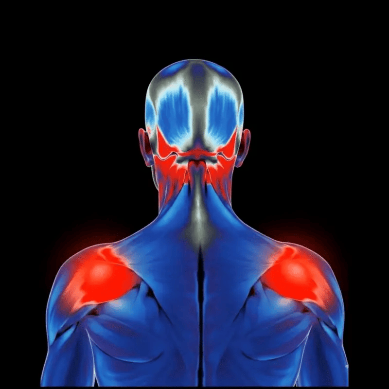 3. Forces Blood Back Into Starving Trigger Points